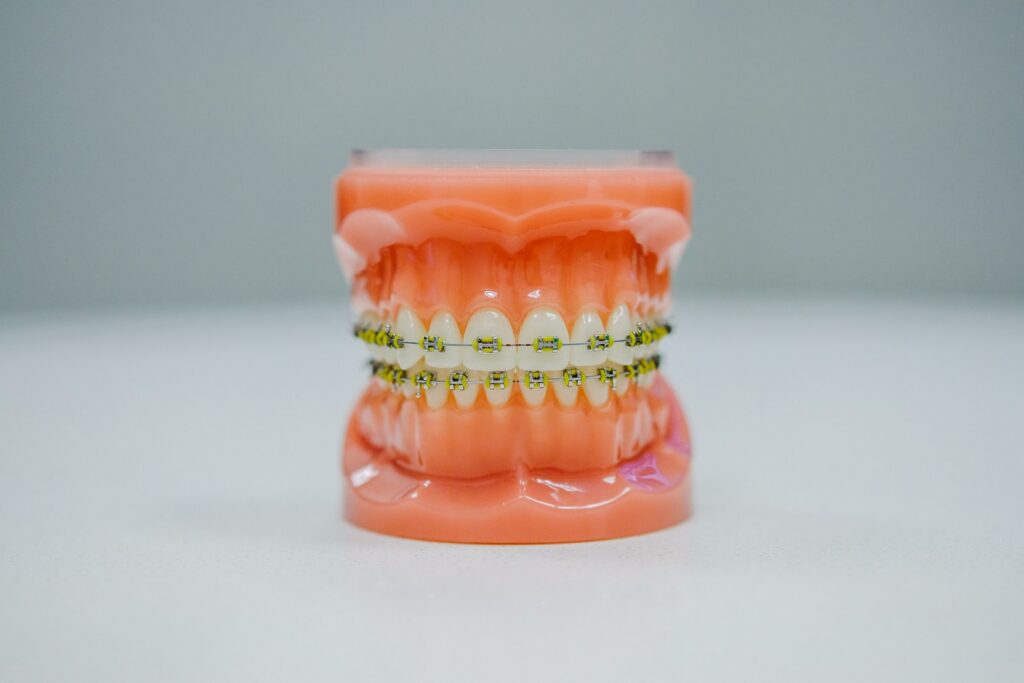 orange green and yellow plastic toy