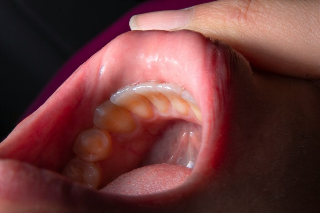 a person holding a baby's mouth