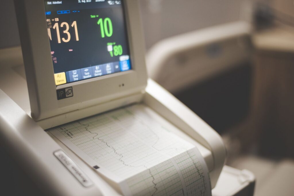 Close-up shot of a medical ECG monitor displaying heart rate and oxygen levels, essential for patient monitoring.